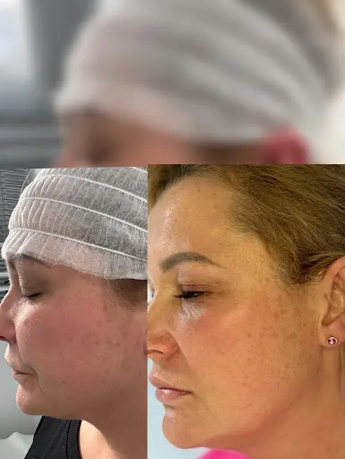 Skinmed Technology - Medycyna estetyczna - Kosmetolog - Depilacja laserowa